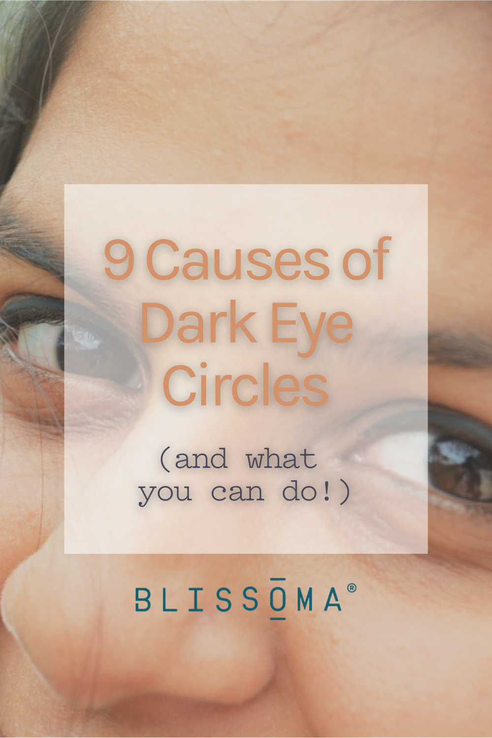 9 Causes of Dark Eye Circles - Take action to reduce dark circles