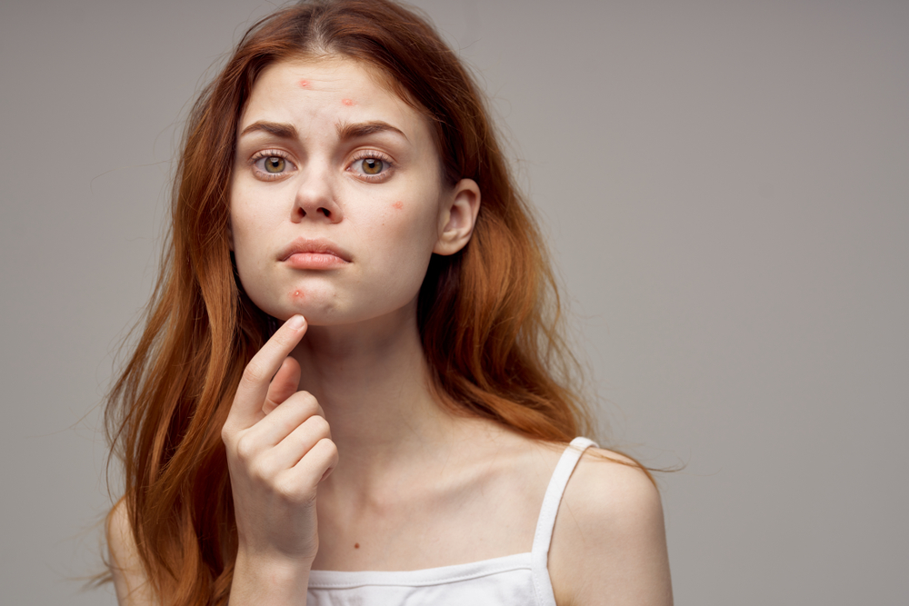 Clogged pores can come from acnegenic ingredients and hyperkeratosis due to dry skin as well as comedogenic ingredients. Learn the truth about acne cosmetica and how to shop for skincare for acne prone skin.