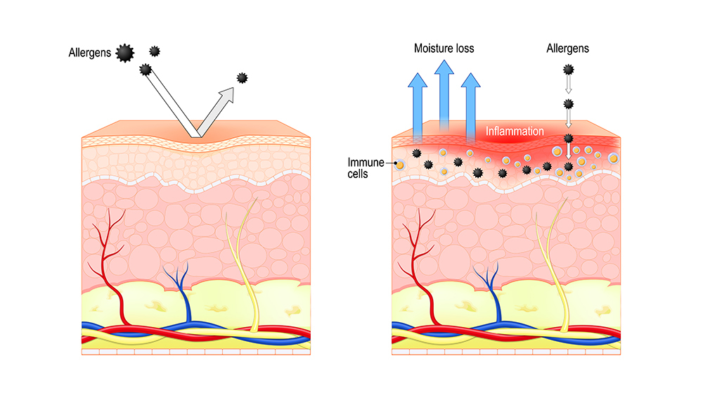 Ectoin benefits skin by reducing inflammation when used in skincare products because it cushions your cells in protective water and improves how cell membranes function.